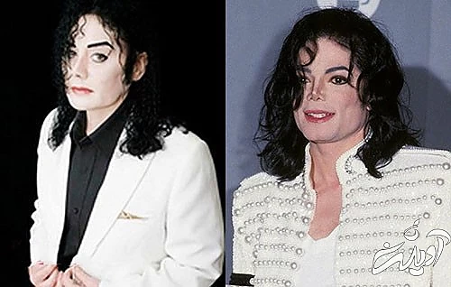 عجیب‌ترین و مضحک‌ترین جراحی‌های زیبایی